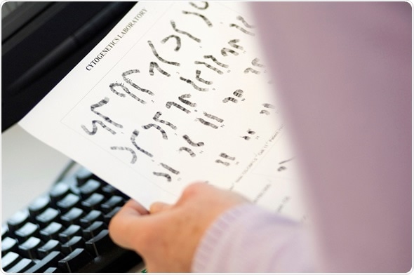 Researcher holding cytogenetic pictures of chromosomes - Image Copyright: RHIMAGE / Shutterstock